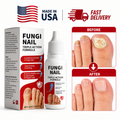 Fungi Nail Anti-Fungal Liquid Herbal Extracts Toenail Fungus Treatment Safe Us Serenzza