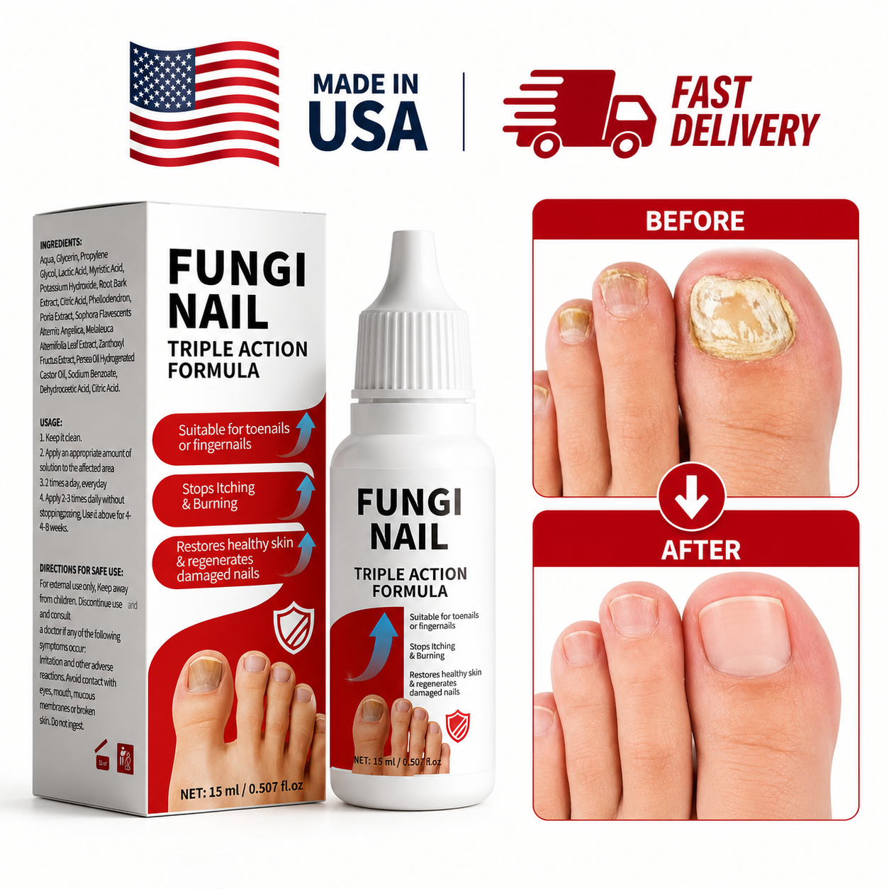 Fungi Nail Anti-Fungal Liquid Herbal Extracts Toenail Fungus Treatment Safe Us Serenzza