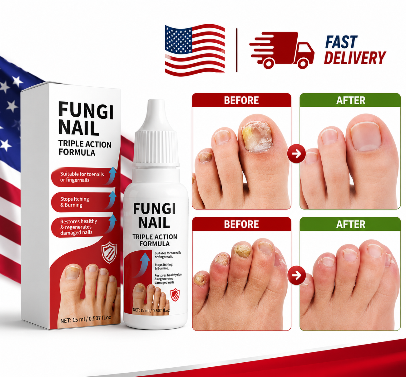 Fungi Nail Anti-Fungal Liquid Herbal Extracts Toenail Fungus Treatment Safe Us Serenzza