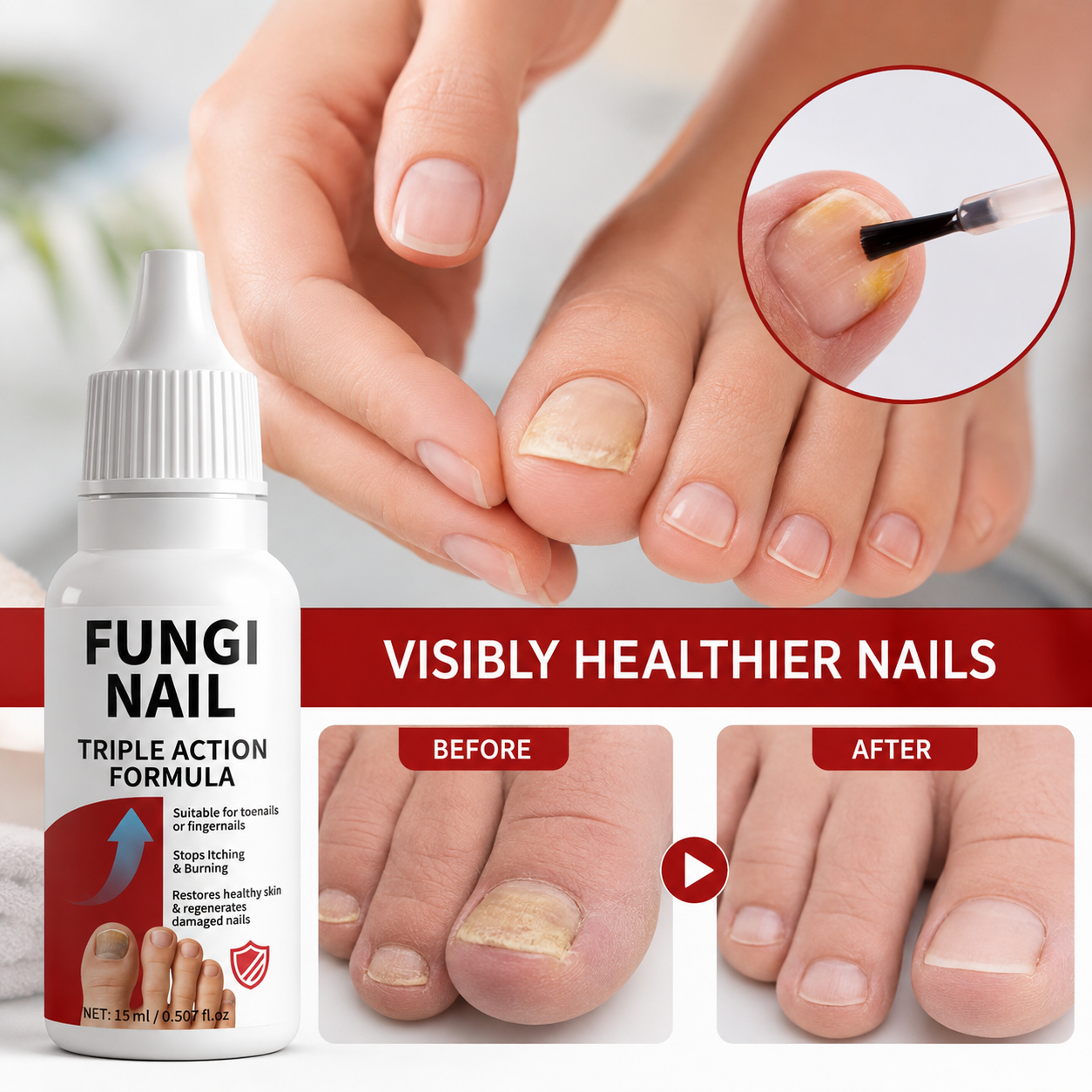 Fungi Nail Anti-Fungal Liquid Herbal Extracts Toenail Fungus Treatment Safe Us Serenzza
