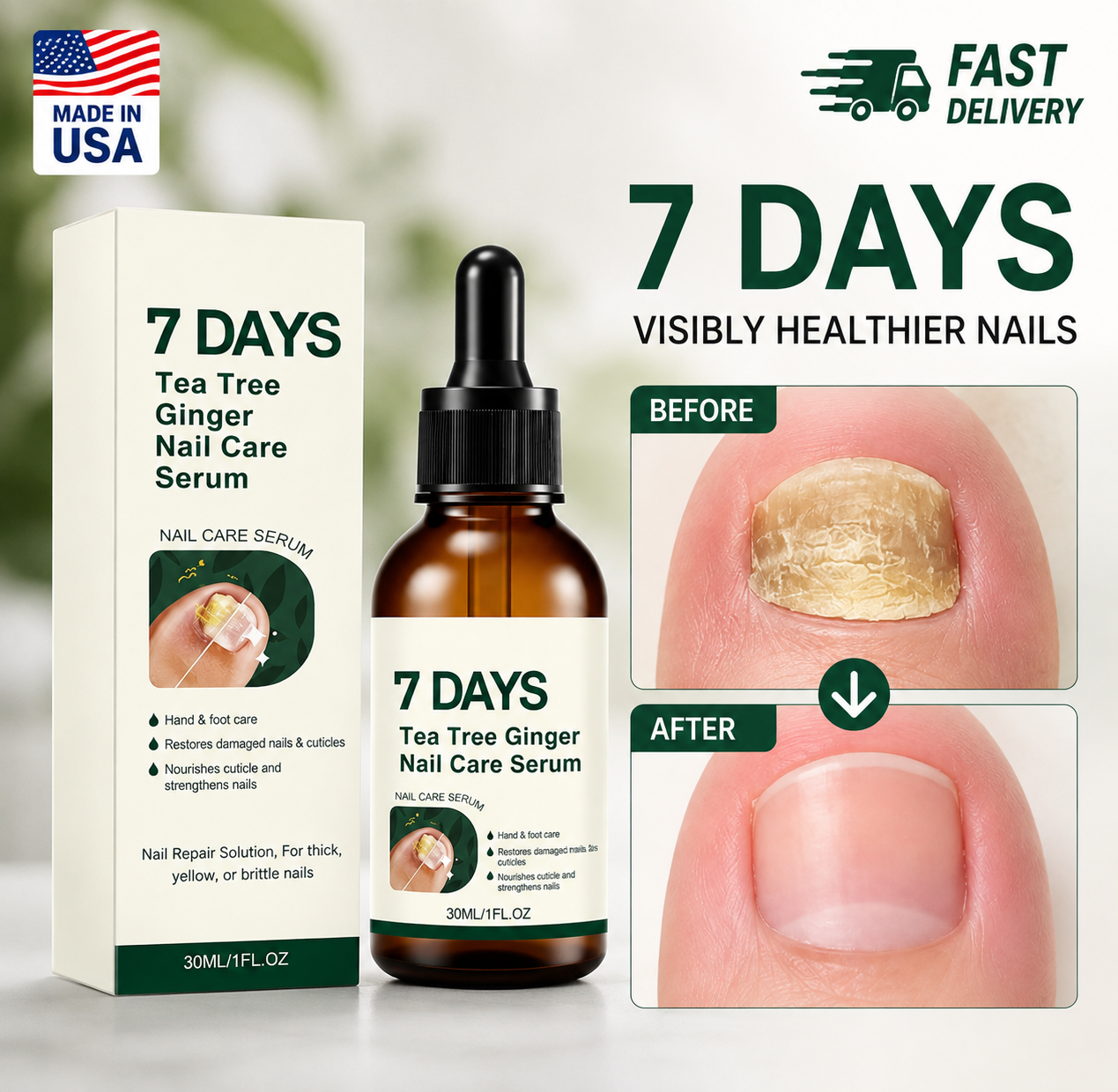 Tea Tree Ginger Nail Treatment Oil Thickened Nails Nail Repair Serum Nail Care Serenzza