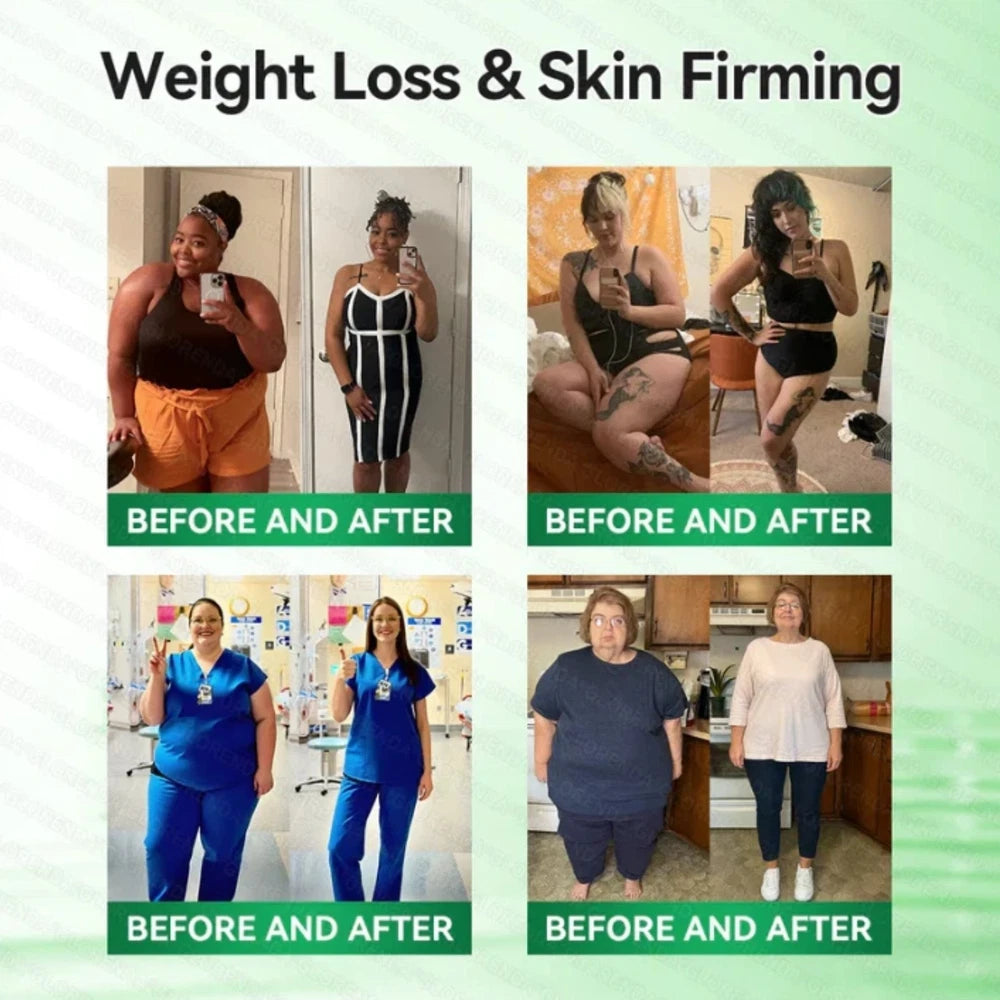 1-5Boxes Moringa Berberine NAD+ Weight Loss Patches Advanced Nano Microneedle Serenzza